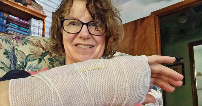 a woman holds her arm up to the camera to show the excessive bandaging the surgeon provided after completing carpal tunnel release surgery